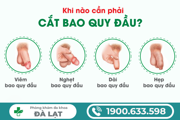 Hình ảnh minh họa